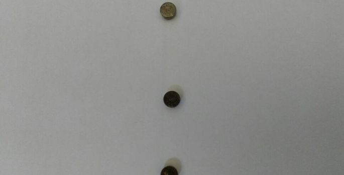 Menina de 2 anos entra em penitenciária com três baterias no intestino