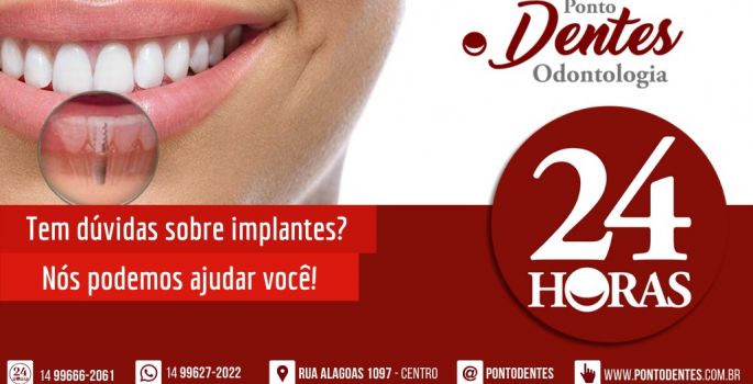 Implantes dentários é na Ponto Dentes Odontologia