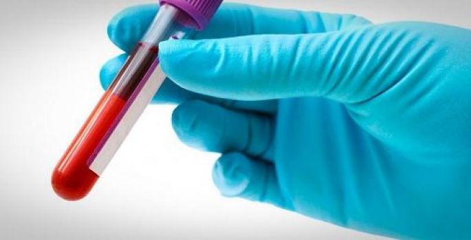 Avaré: Postos disponibilizam teste rápido para detecção de HIV e Sífilis