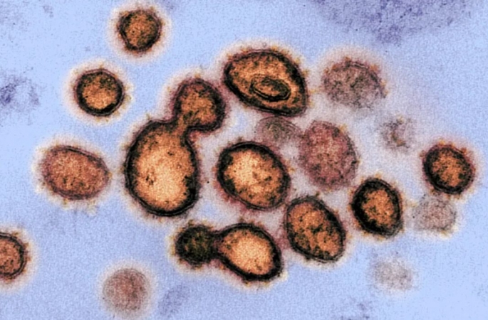 Covid-19: Cientistas descobrem variante