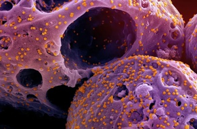 Covid: rede global de virologistas faz alerta sobre nova variante BA.3.2, com maior escape imunológico; entenda o risco