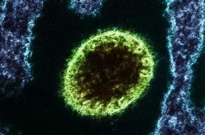 Ministério da Saúde emite alerta sobre o Vírus Nipah no Brasil