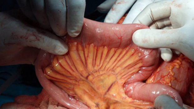 Mesentério: cientistas descobrem novo órgão do corpo humano