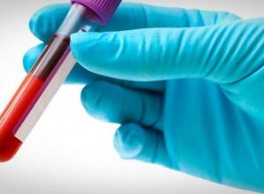 Avaré: Postos disponibilizam teste rápido para detecção de HIV e Sífilis