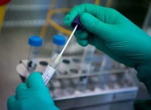 Botucatu contabiliza 35 casos suspeitos de coronavírus