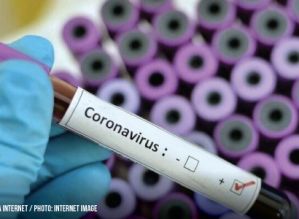 Em dois dias, Avaré registrou duas mortes  por Covid-19