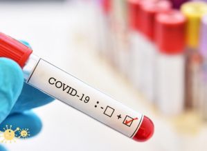 Covid- 19: Avaré tem 7 novos casos e 68 novos casos descartados de ontem para hoje
